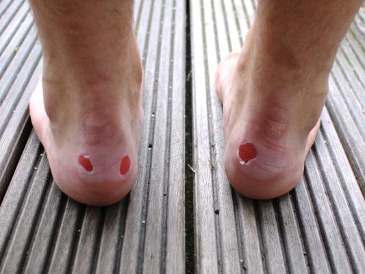 A new way to prevent blisters (and slipping) in loafers and boat shoes
